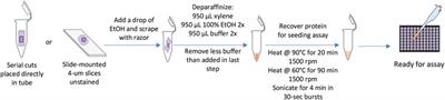 New protocol for kinetic assay seeding ability recovery “KASAR” from formalin-fixed paraffin-embedded tissues